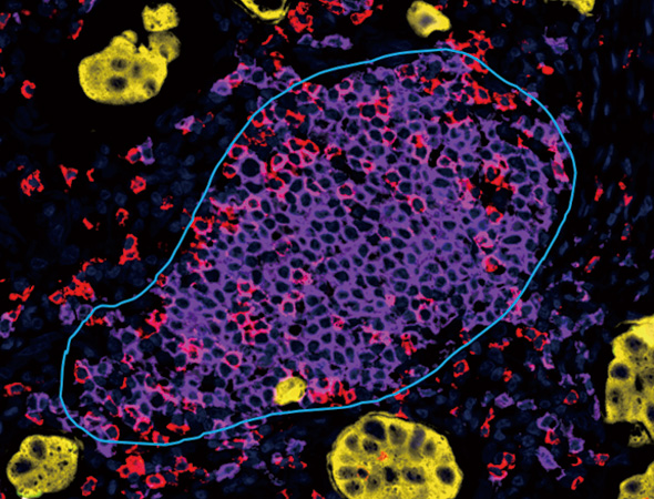 多重免疫荧光检测技术服务