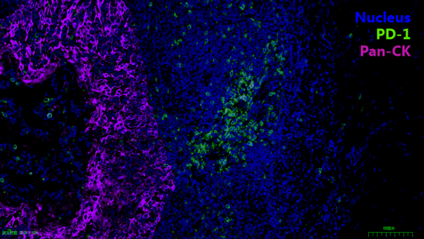 人扁桃体组织  2标3色
