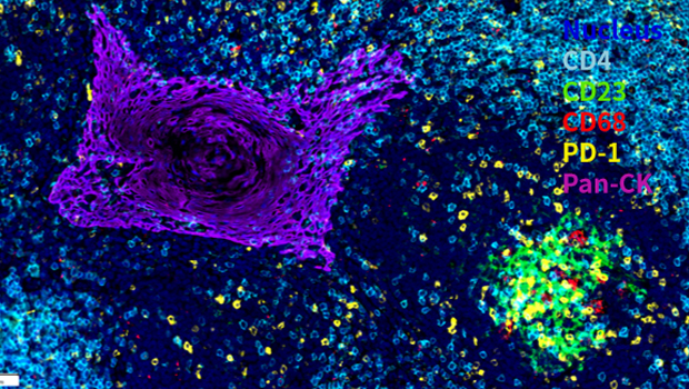 人扁桃体组织  5标6色