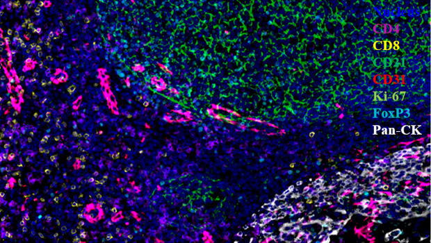 人扁桃体组织  7标8色